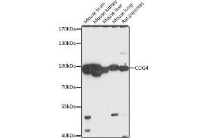 Western blot analysis of extracts of various cell lines, using COG4 antibody (ABIN7266486) at 1:1000 dilution. (COG4 抗体  (AA 310-410))