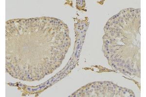 ABIN6272415 at 1/100 staining RAT testis tissue by IHC-P. (RHOBTB3 抗体  (Internal Region))