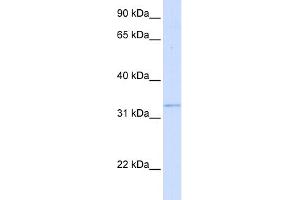 WB Suggested Anti-GGPS1 Antibody Titration:  0. (GGPS1 抗体  (Middle Region))