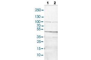 Western blot analysis of Lane 1: NIH/3T3 cell lysate and Lane 2: NBT-II cell lysate with CD36 polyclonal antibody . (CD36 抗体  (AA 42-178))