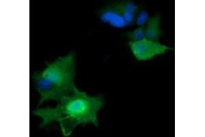 Image no. 2 for anti-HRas proto-oncogene, GTPase (HRAS) antibody (ABIN1498715) (HRAS 抗体)