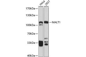 MALT1 抗体  (AA 125-450)