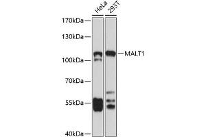 Western blot analysis of extracts of various cell lines, using M antibody (ABIN3023031, ABIN3023032, ABIN3023033, ABIN1513170 and ABIN6219356) at 1:1000 dilution. (MALT1 抗体  (AA 125-450))