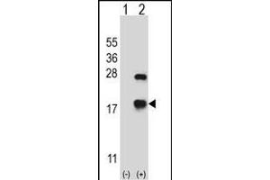 Western blot analysis of CRYAB (arrow) using rabbit polyclonal CRYAB Antibody (Center) (ABIN657620 and ABIN2846616). (CRYAB 抗体  (AA 84-112))