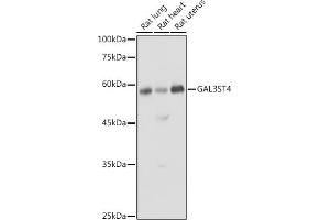Western blot analysis of extracts of various cell lines, using GST4 antibody (ABIN6135004, ABIN6140932 and ABIN7101748) at 1:1000 dilution. (GAL3ST4 抗体)