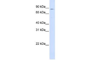 WB Suggested Anti-CPT1A Antibody Titration:  0. (CPT1A 抗体  (Middle Region))