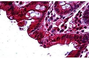 Human Colon: Formalin-Fixed, Paraffin-Embedded (FFPE) (TAB2 抗体  (AA 161-173))