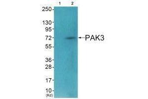 Western blot analysis of extracts from HeLa cells (Lane 2), using PAK3 (Ab-154) antiobdy. (PAK3 抗体  (Ser154))