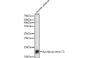 Western blot analysis of extracts of Human plasma cells, using Apolipoprotein C3 antibody (ABIN7265640) at 1:1000 dilution.