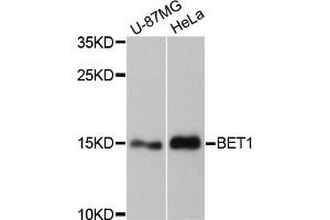 Western blot analysis of extracts of various cell lines, using BET1 antibody. (BET1 抗体)