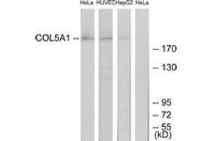 Western Blotting (WB) image for anti-Collagen, Type V, alpha 1 (COL5A1) (AA 301-350) antibody (ABIN2889916) (COL5A1 抗体  (AA 301-350))