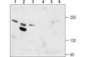 Western blot analysis of rat kidney (lanes 1 and 4), rat testis (lanes 2 and 5) and mouse kidney (lanes 3 and 6) lysates: - 1-3. (TRPM6 抗体  (1st Extracellular Loop))