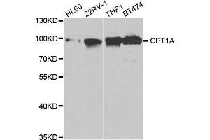 Western Blotting (WB) image for anti-Carnitine Palmitoyltransferase 1A (Liver) (CPT1A) antibody (ABIN1876495)
