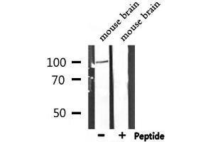 Western blot analysis of extracts from mouse brain, using DLG1 Antibody. (DLG1 抗体  (Internal Region))