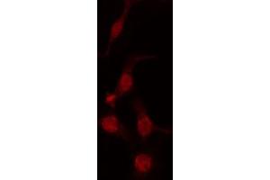 ABIN6274233 staining Hela cells by IF/ICC. (GTF2H1 抗体  (N-Term))