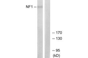 Western blot analysis of extracts from HepG2 cells, using NF1 antibody. (Neurofibromin 1 抗体  (Internal Region))