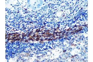 Immunohistochemistry of paraffin-embedded human appendix using CD79B Rabbit mAb (ABIN1682474, ABIN3018855, ABIN3018856 and ABIN7101674) at dilution of 1:100 (40x lens).