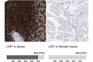 Immunohistochemical staining (Formalin-fixed paraffin-embedded sections) of human spleen and skeletal muscle tissues. (LCP1 抗体  (AA 18-77))