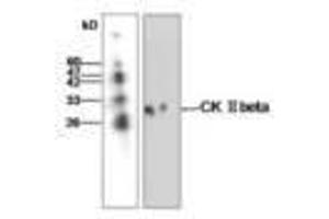Image no. 1 for anti-Casein Kinase 2, beta (CSNK2B) antibody (ABIN791462) (CSNK2B 抗体)