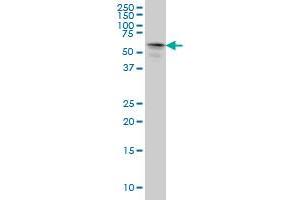 STK33 monoclonal antibody (M03), clone 4A12 Western Blot analysis of STK33 expression in HeLa . (STK33 抗体  (AA 1-514))