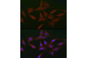 Immunofluorescence analysis of NIH/3T3 cells using A Rabbit pAb (ABIN3015791, ABIN3015792, ABIN3015793 and ABIN6219141) at dilution of 1:50 (40x lens). (ACVR2A 抗体  (AA 20-140))