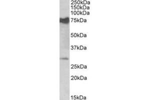 AP31405PU-N NMNAT3 antibody staining of Mouse Heart lysate at 0. (NMNAT3 抗体  (Internal Region))