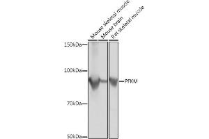 Western blot analysis of extracts of various cell lines, using PFKM Rabbit mAb (ABIN1678746, ABIN7101548, ABIN7101549 and ABIN7101550) at 1:1000 dilution. (PFKM 抗体)