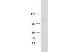 ZBTB2 Protein (Myc-DYKDDDDK Tag)