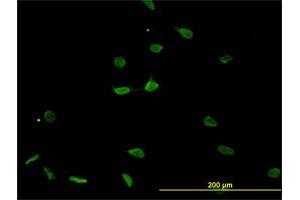 Immunofluorescence (IF) image for anti-Proteasome (Prosome, Macropain) Subunit, beta Type, 8 (Large Multifunctional Peptidase 7) (PSMB8) (AA 173-272) antibody (ABIN562483)