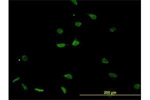 Immunofluorescence of monoclonal antibody to PSMB8 on HeLa cell.
