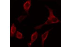 ABIN6274647 staining LOVO cells by IF/ICC. (Cytochrome P450 2C8/9/18/19 抗体)