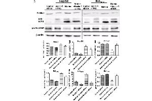Western Blotting (WB) image for anti-Sequestosome 1 (SQSTM1) (AA 51-150) antibody (ABIN682153)