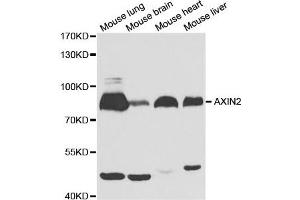 Western Blotting (WB) image for anti-Axin 2 (AXIN2) antibody (ABIN1875444) (AXIN2 抗体)