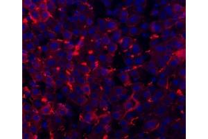 anti-CD81 (CD81) (AA 116-201) antibody