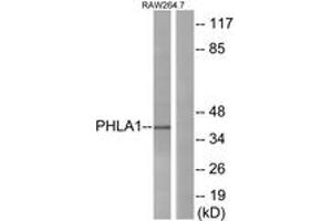Western blot analysis of extracts from RAW264. (PHLDA1 抗体  (AA 271-320))