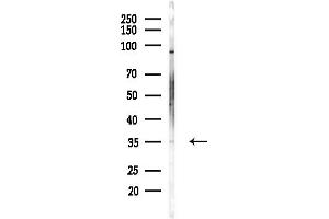 anti-HCLS1 Associated Protein X-1 (HAX1) (C-Term) antibody