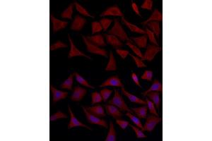 Immunofluorescence analysis of HeLa cells using TLR4 Rabbit pAb (ABIN6134489, ABIN6149223, ABIN6149226 and ABIN6220893) at dilution of 1:100 (40x lens). (TLR4 抗体  (AA 500-600))