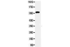 Observed bind size: 61KD (HNF1B 抗体  (C-Term))