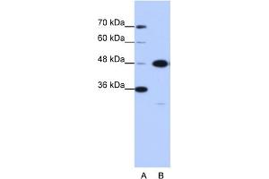 WB Suggested Anti-GTPBP9 Antibody Titration:  0.