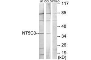 Western blot analysis of extracts from Jurkat/COLO205 cells, using NT5C3 Antibody. (NT5C3 抗体  (AA 11-60))