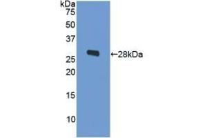Detection of Recombinant ODC, Human using Polyclonal Antibody to Ornithine Decarboxylase (ODC) (ODC1 抗体  (AA 15-259))