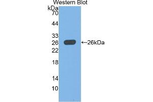 Detection of Recombinant UCHL1, Rat using Polyclonal Antibody to Ubiquitin Carboxyl Terminal Hydrolase L1 (UCHL1) (UCHL1 抗体  (AA 2-223))