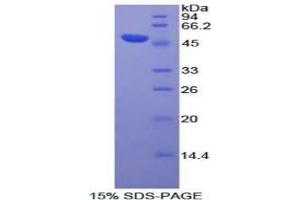 SDS-PAGE analysis of Human DVL3 Protein. (DVL3 蛋白)