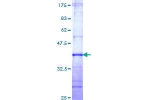 MTR Protein (AA 1094-1203) (GST tag)