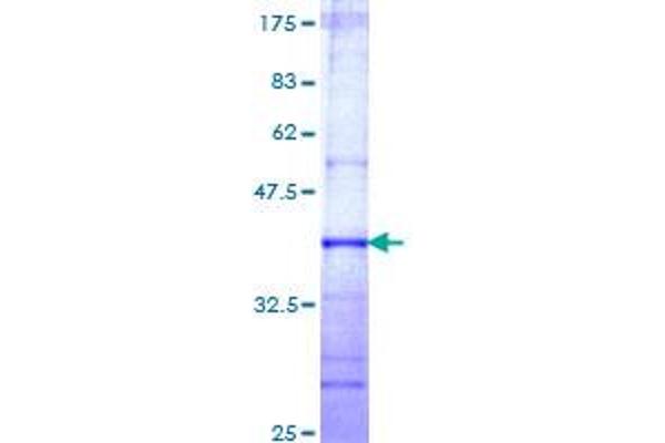MTR Protein (AA 1094-1203) (GST tag)