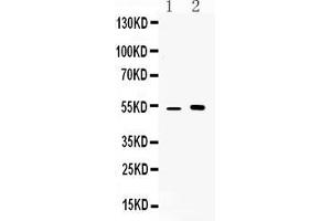 Western Blotting (WB) image for anti-Cerebellar Degeneration-Related Protein 2, 62kDa (CDR2) (AA 232-2656), (Middle Region) antibody (ABIN5518746)