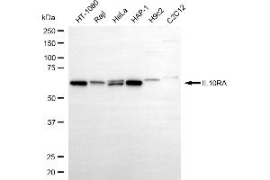 anti-Interleukin 10 Receptor, alpha (IL10RA) antibody