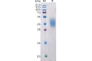 SDS-PAGE (SDS) image for Programmed Cell Death 1 Ligand 2 (PDCD1LG2) (AA 20-219) protein (His tag) (ABIN6964115)