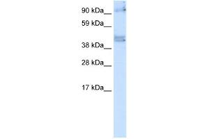 WB Suggested Anti-SIRT2 Antibody   Titration: 5 ug/ml   Positive Control: Fetal Brain (SIRT2 抗体  (N-Term))