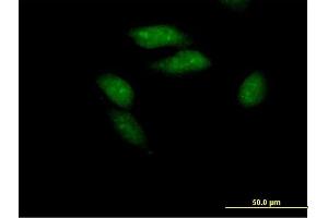Immunofluorescence of purified MaxPab antibody to PCGF3 on HeLa cell. (PCGF3 抗体  (AA 1-242))